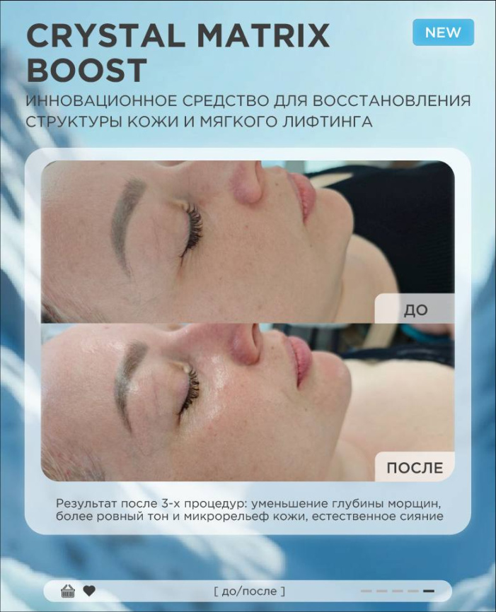 Биотайм Хрусталь матрикс буст (Biotime Crystal matrix boost), ампулы 5*2мл фото 6