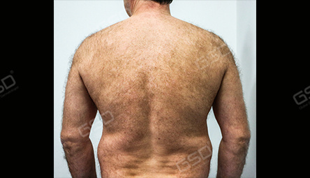 Диодный лазер COOLITE BOLT 1800W фото 4