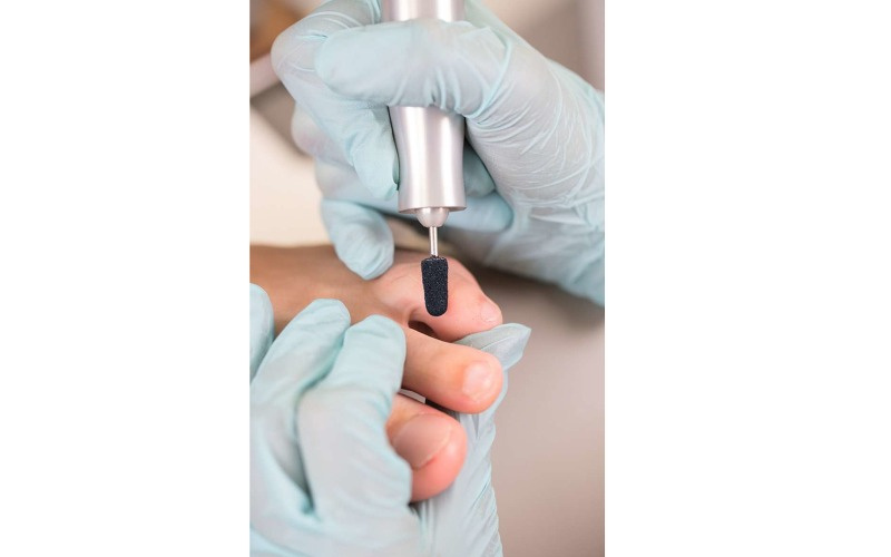 Колпачок шлиф. d=16 мм, мелкая крошка фото 5